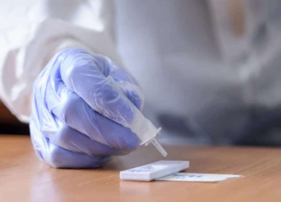 Za pondelok malo pozitívny výsledok PCR testu 41 osôb, pribudlo 11 hospitalizovaných