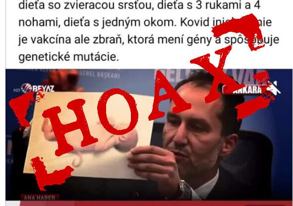 Očkovaným rodičom sa vraj narodilo dieťa s chvostom, ide o hoax