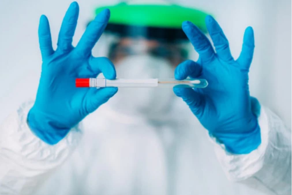 Za piatok nepribudli úmrtia ani hospitalizácie v súvislosti s koronavírusom