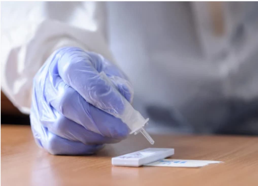 Za sobotu pribudlo 7367 pozitívne testovaných na koronavírus