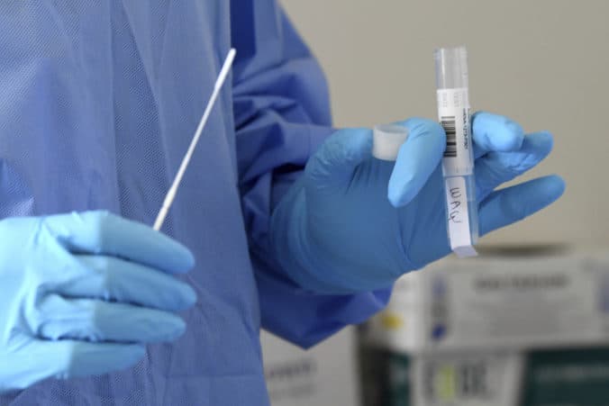 Na získanie potvrdenia o prekonaní COVID-19 stačí aj pozitívny AG test