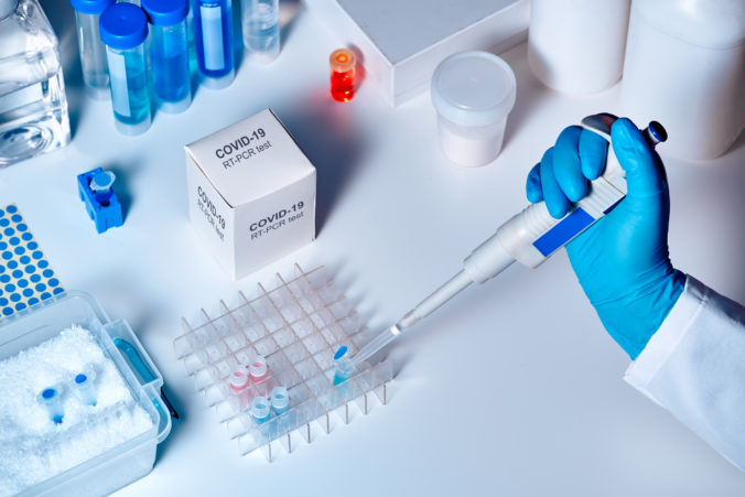 PCR testy odhalili v sobotu 80 nových pozitívnych