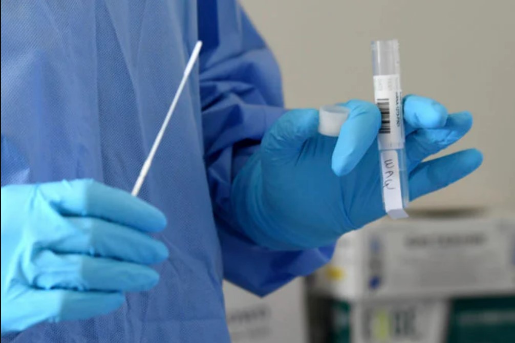 V pondelok na Slovensku odhalili PCR testy takmer 19-tisíc nakazených, pribudlo 18 obetí